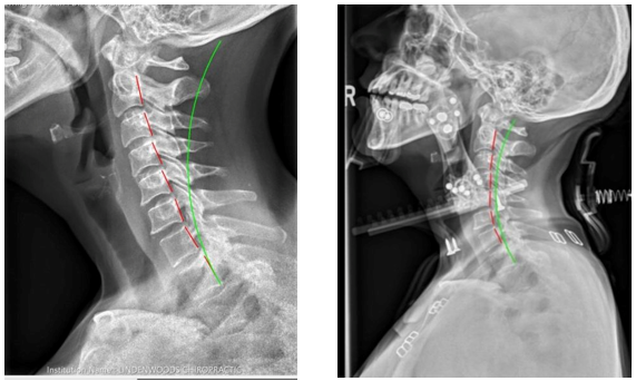 Cervigard Traction Collar Training Webinar - January 25th, 2025